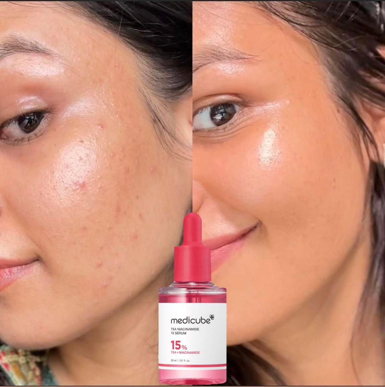 Medicube 15% TXA Niacinamide Serum