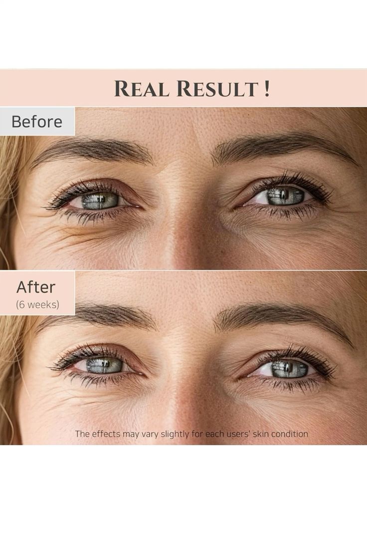 Beauty Of Joseon Revive Eye Serum : Ginseng + Retinal