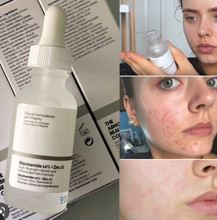 The Ordinary Niacinamide 10% + Zinc 1%