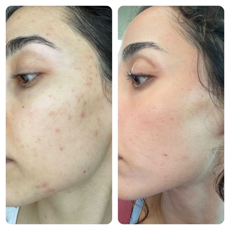 The Ordinary Vitamin C Suspension 30% in Silicone
